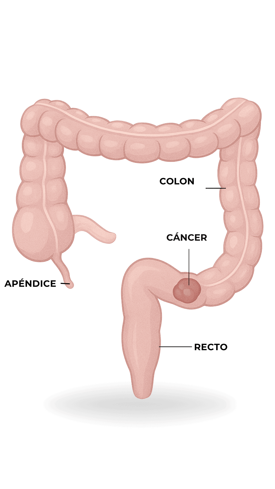 Anatomía - Cáncer Colorrectal