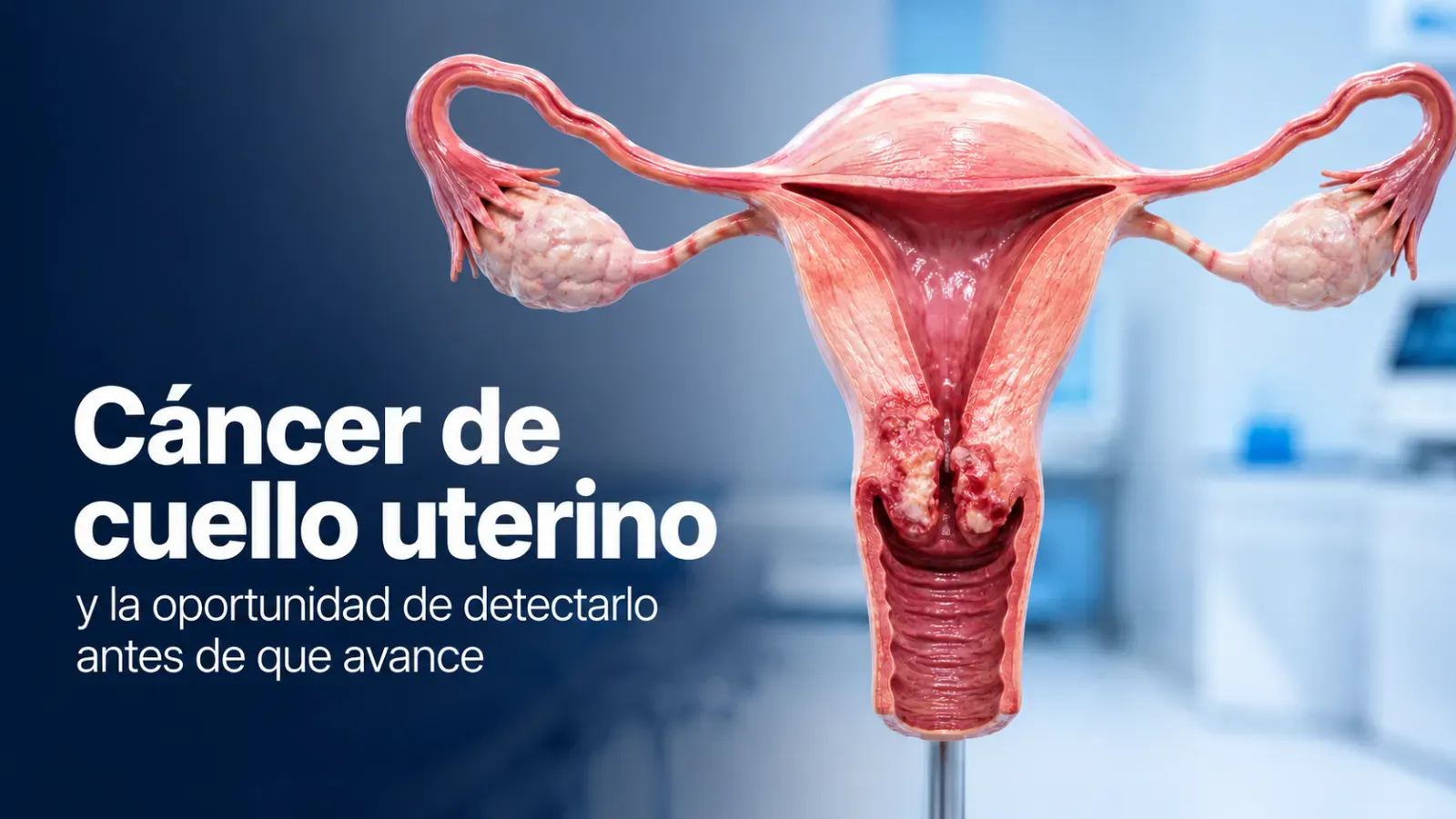 Cáncer de cuello uterino y la oportunidad de detectarlo antes de que avance Puedes detectarlo antes de que avance