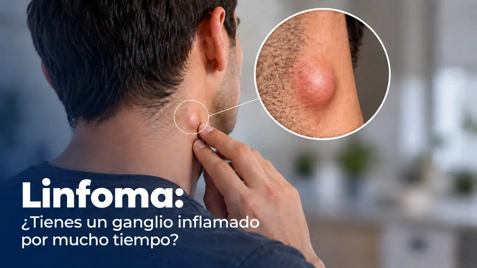 hombre con ganglio inflamado