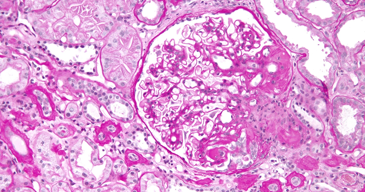 Laboratorio de Anatomía Patológica