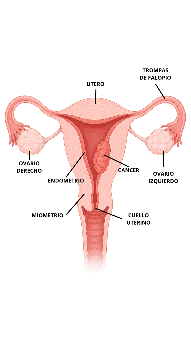 Anatomía - Cáncer de endometrio