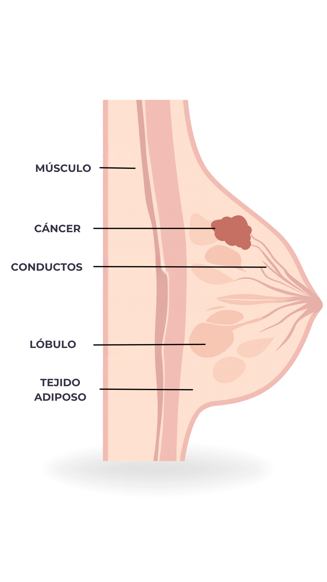 Anatomía - Cáncer de mama