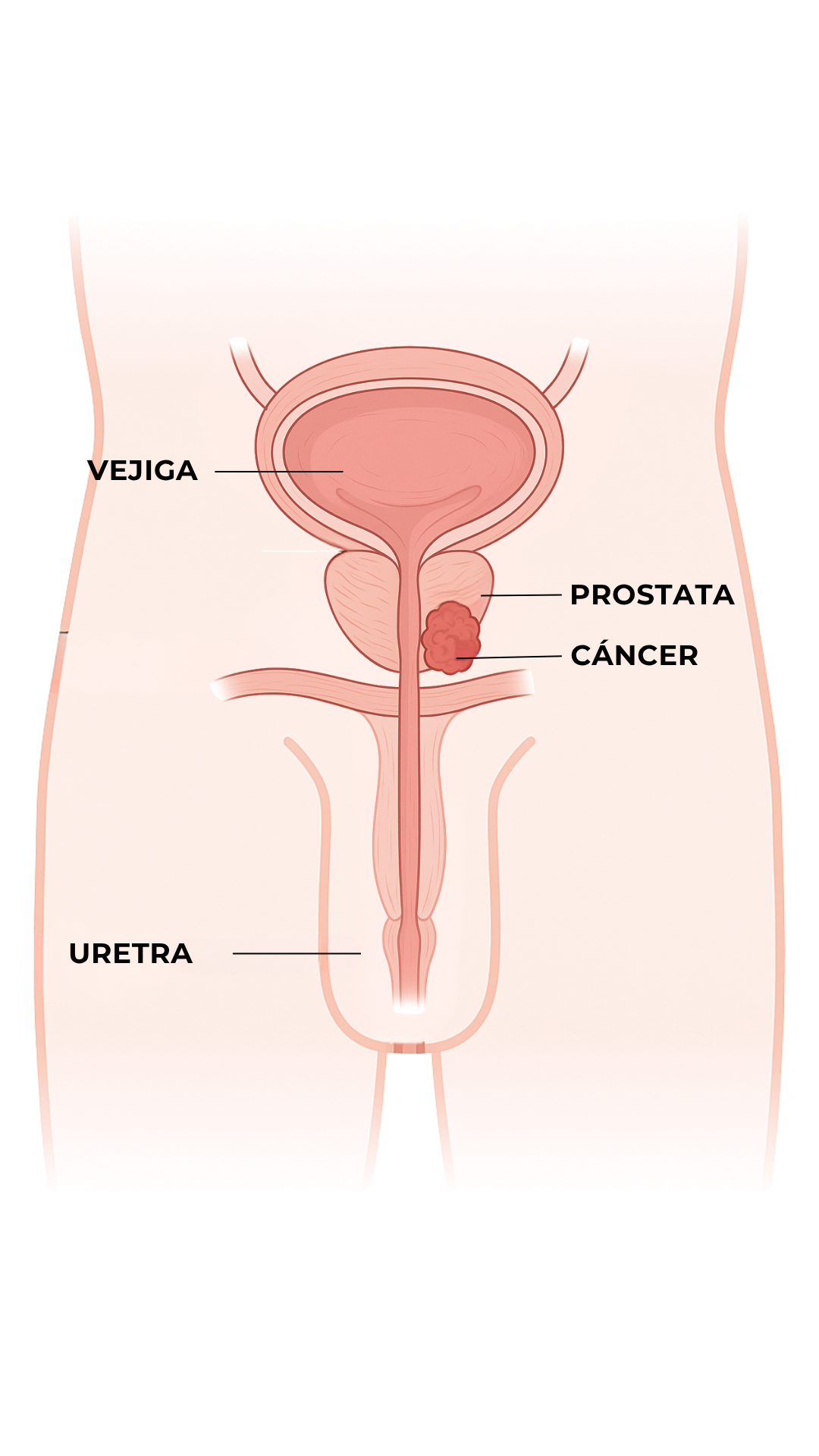 Anatomía - Cáncer de Próstata
