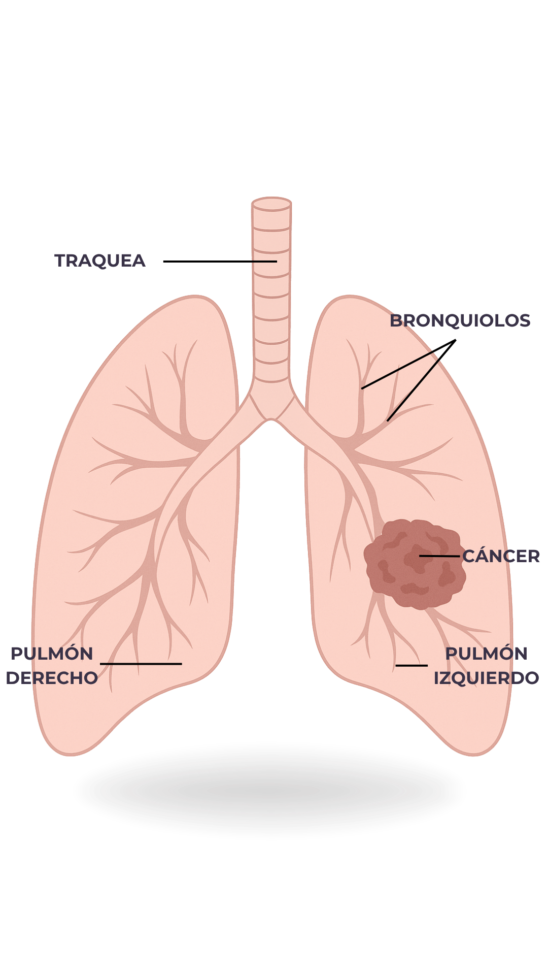 Anatomía - Cáncer de Pulmón