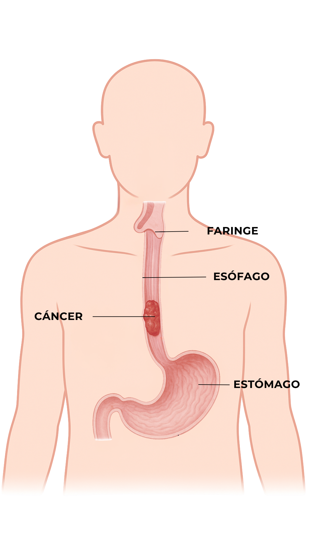 Anatomía - Cáncer de Esófago